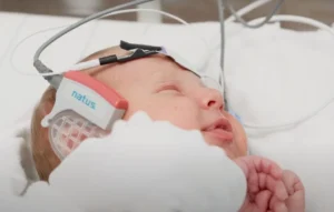 Screenshot_27-2-2025_153747_natus.com